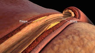 LDL and HDL Cholesterol  Good and Bad Cholesterol  Nucleus Health [upl. by China240]