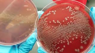 Microbiology Urine Culture Primary SetUp Inoculation and Colony Count [upl. by Aridni774]