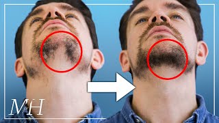 How To Fix Your Patchy Beard… Fast [upl. by Kcim455]