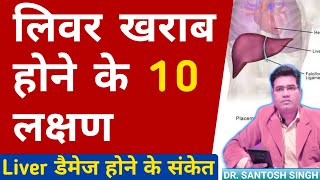 Liver Kharab Hone Ke Lakshan  Liver Damage Symptoms and Sign Explained [upl. by Savil]