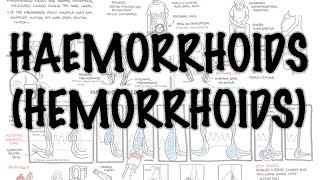 Haemorrhoids Hemorrhoids  Overview pathophysiology investigations and treatment [upl. by Earlene]