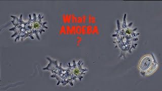 What is Amoeba [upl. by Crystal291]