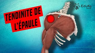 COMPRENDRE LA TENDINITE DE LÉPAULE Explications professionelles [upl. by Yattirb]