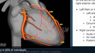 This Video Can Save Your Life Pt2 Catheter Angiogram Stentmov [upl. by Efi]