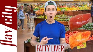 Top 10 Foods For Reversing FATTY LIVER DISEASEAnd What To Avoid [upl. by Harmony]