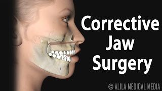 6 Effective Jaw Release Exercises  Ask Dr Abelson [upl. by Graniah]