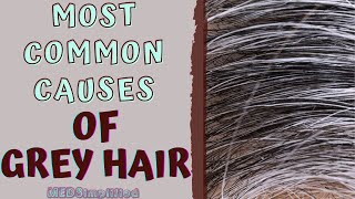 MOST COMMON CAUSES OF GREY HAIR [upl. by Hselin869]