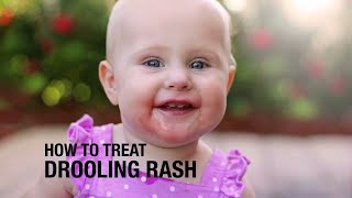 How to treat Drooling Rash [upl. by Donahue825]